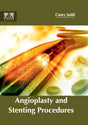 Angioplasty and Stenting Procedures - Retail Maharaj