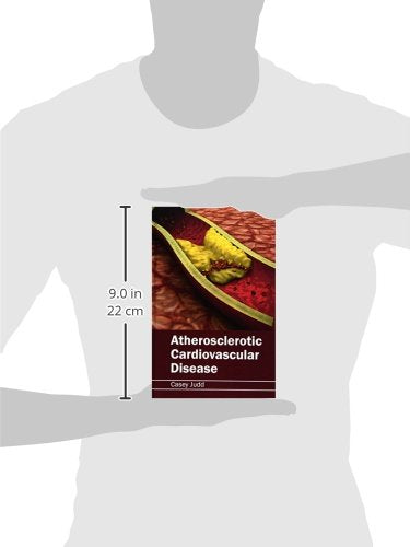Atherosclerotic Cardiovascular Disease - Retail Maharaj