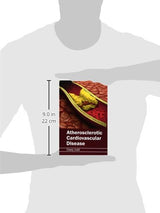 Atherosclerotic Cardiovascular Disease - Retail Maharaj