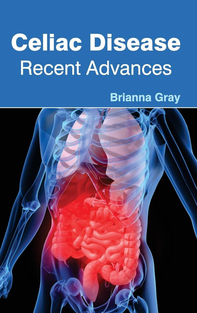 Celiac Disease: Recent Advances - Retail Maharaj