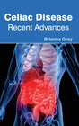 Celiac Disease: Recent Advances - Retail Maharaj