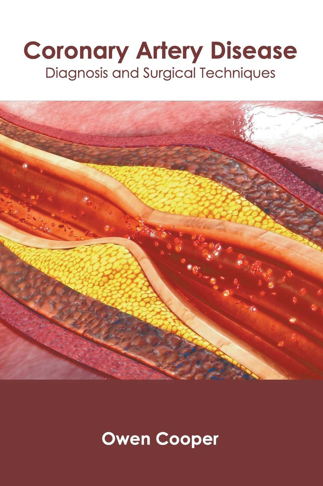 Coronary Artery Disease: Diagnosis and Surgical Techniques - Retail Maharaj