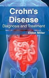 Crohn's Disease: Diagnosis and Treatment - Retail Maharaj