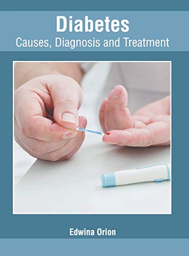 Diabetes: Causes, Diagnosis and Treatment - Retail Maharaj