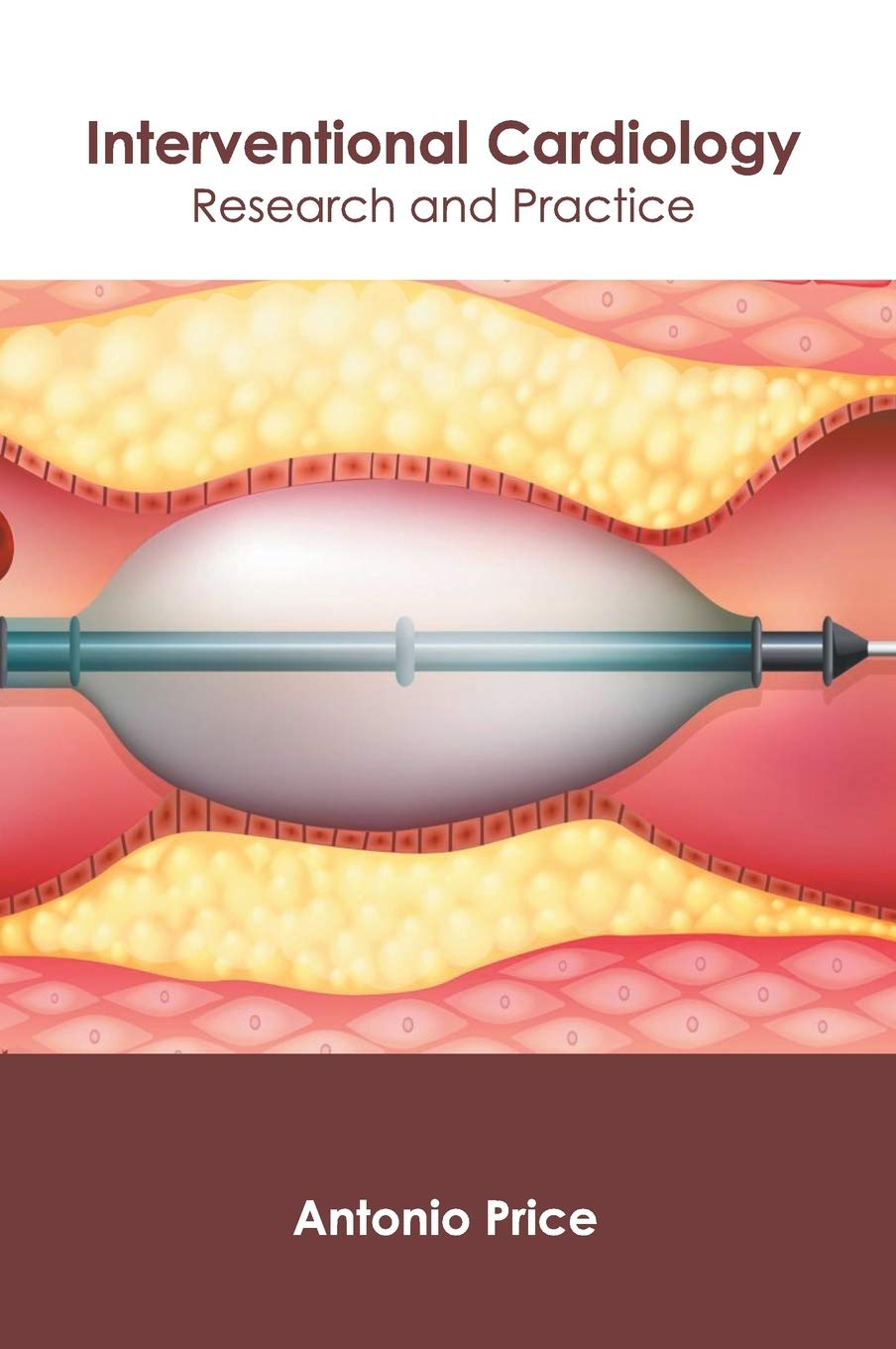 Interventional Cardiology: Research and Practice - Retail Maharaj
