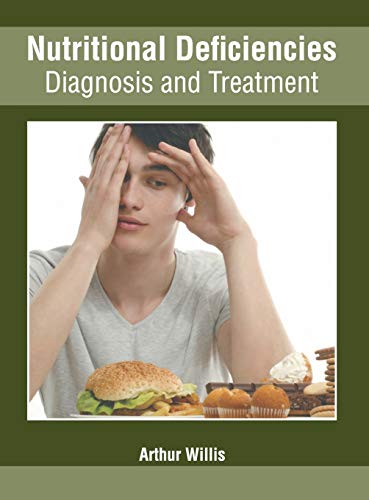 Nutritional Deficiencies: Diagnosis and Treatment - Retail Maharaj