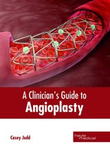 A Clinician's Guide to Angioplasty - Retail Maharaj