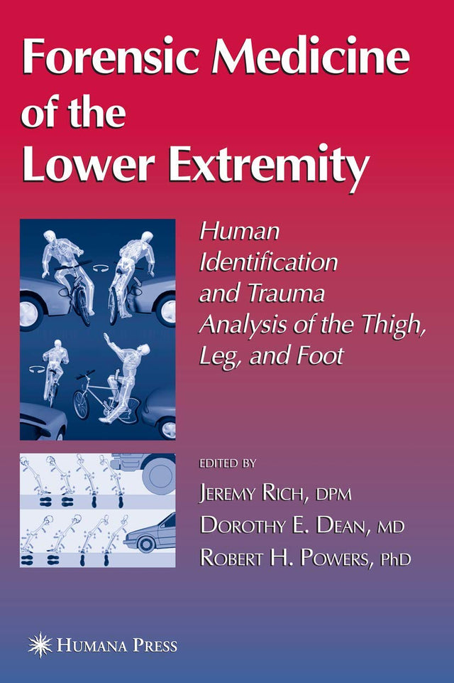 Forensic Medicine of the Lower Extremity (Forensic Science and Medicine) - Retail Maharaj