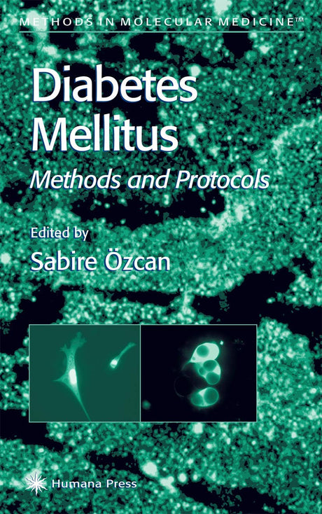 Diabetes Mellitus: 83 (Methods in Molecular Medicine) - Retail Maharaj