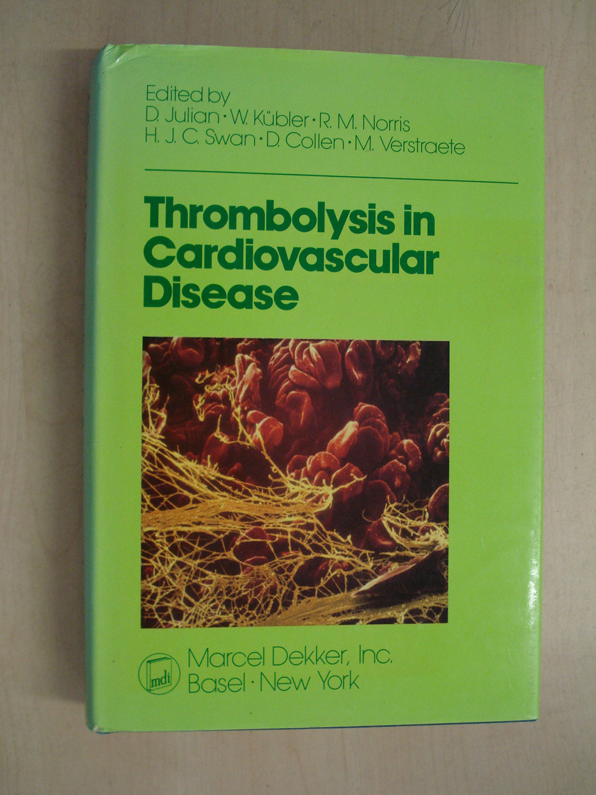 Thrombolysis in Cardiovascular Disease - Retail Maharaj