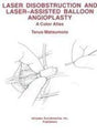 Laser Disobstruction and Laser-assisted Balloon Angioplasty - Retail Maharaj