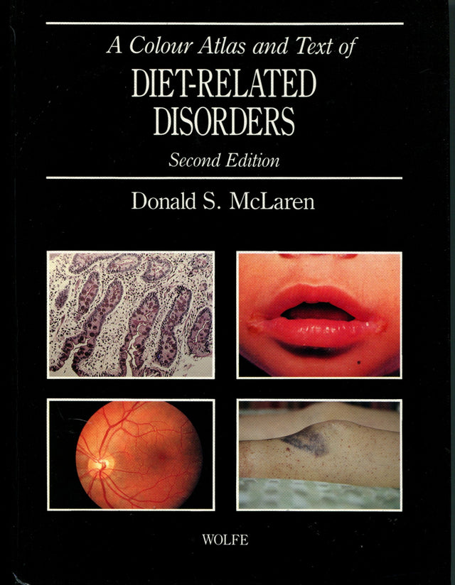 A Colour Atlas and Text of Diet-related Disorders - Retail Maharaj