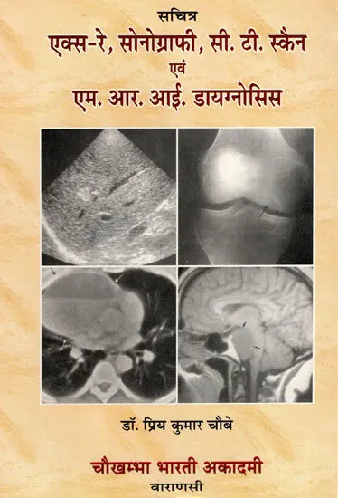एक्स-रे, सोनोग्राफी, सी.टी. स्कैन एवं एम.आर.आई. डायगनोसिस - X-Ray, Sonography, C.T. Scan & M.R.I. Diagnosis (with Radiographs) - Retail Maharaj