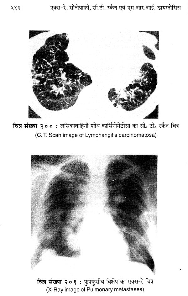 एक्स-रे, सोनोग्राफी, सी.टी. स्कैन एवं एम.आर.आई. डायगनोसिस - X-Ray, Sonography, C.T. Scan & M.R.I. Diagnosis (with Radiographs) - Retail Maharaj