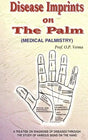 Disease Imprints on The Palm (Medical Palmistry) - Retail Maharaj