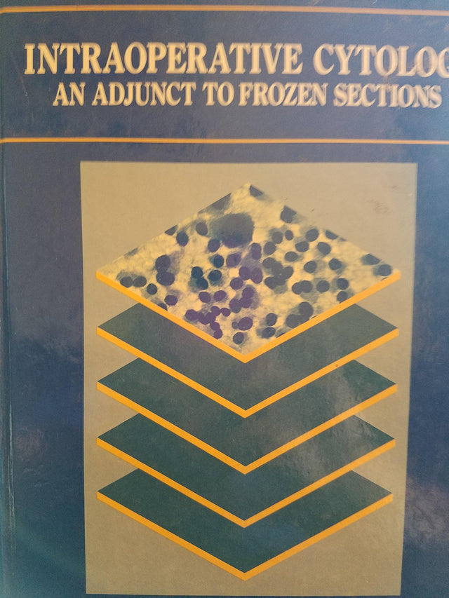 Intraoperative Cytology: Adjunct to Frozen Sections - Retail Maharaj
