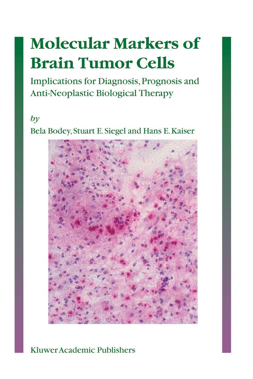MOLECULAR MARKERS OF BRAIN TUMOR CELLS (HB): Implications for Diagnosis, Prognosis and Anti-Neoplastic Biological Therapy - Retail Maharaj