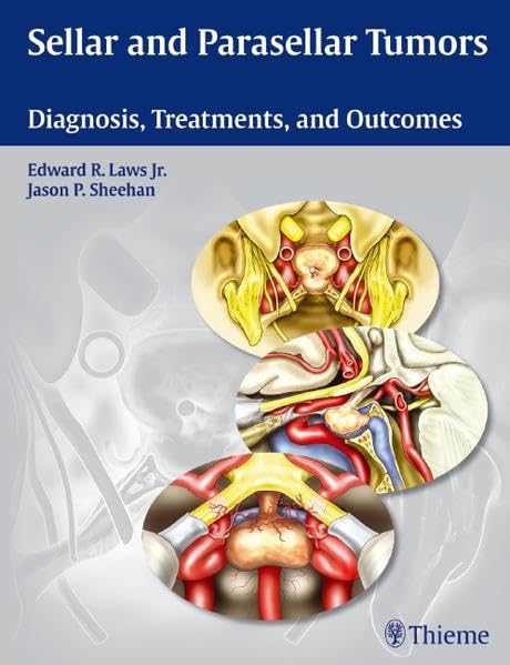 Sellar and Parasellar Tumors: Diagnosis, Treatments and Outcomes - Retail Maharaj