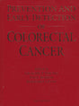 Prevention and Early Detection of Colorectal Cancer - Retail Maharaj