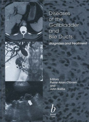 Diseases of the Gallbladder and Bile Ducts: Diagnosis and Treatment - Retail Maharaj